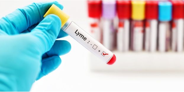 Diagnostic délicat de la Borréliose de Lyme